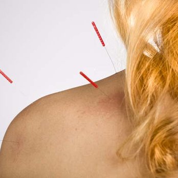 NY Four Seasons Acupuncture - Acupuncture for Shoulder Pain - Acupuncture Near Me - New York, New York NY Four Seasons Acupuncture - Acupuncture for Shoulder Pain - Acupuncture Near Me - New York, New York
