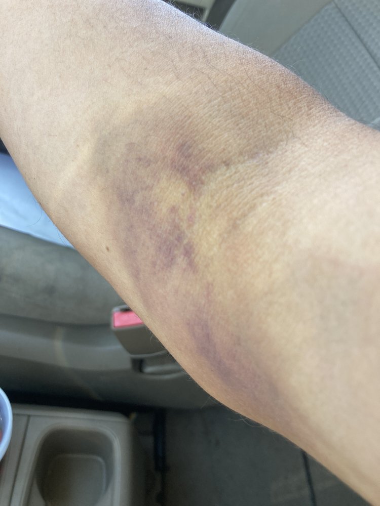 CSL PLASMA 2617 Northland Plaza Dr, Columbus, Ohio Blood & Plasma