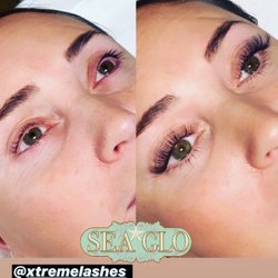 Sea Glo Med Spa + Wellness - We love a perfect application