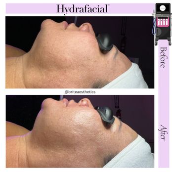 Brite Aesthetics - Skin Care Near Me - Corona, California