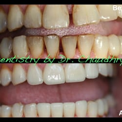 Advanced Aesthetic & Implant Dentistry
