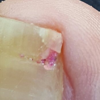 Euro Nails Spa - I was told by the manager and other employees that this was just old polish Andy nail was not damaged by their employee. - Nail Salons Near Me - Riverside, California
