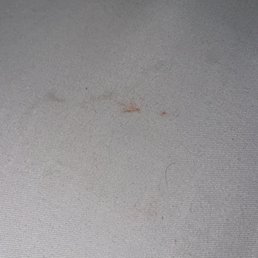 Blood on sheets Blood on sheets