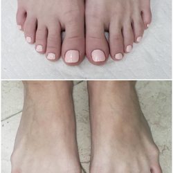 Before and after one gel pedicure