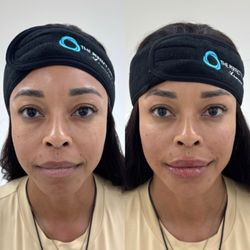 Before/After