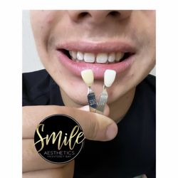 Smile Aesthetics Monterey Bay
