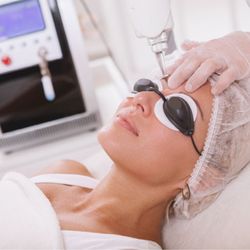 Angel Beauty - LASER TATOO REMOVAL