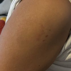 Dr Reynaldo J Carreon Jr Academy - My son got attacked & bit by another special needs student