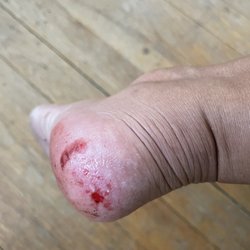 In Style Nail Spa - Painful