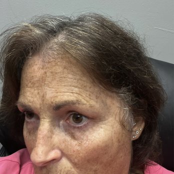 Forever Young Salon - Me before - Nail Salons Near Me - Redding, California Forever Young Salon - Me before - Nail Salons Near Me - Redding, California