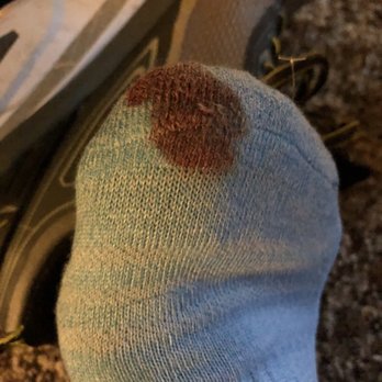 At Nails - Blood soaked sock - Nail Salons Near Me - Portland, Oregon