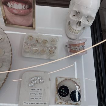 Identity Body Piercing - Tooth gems! - Jewelry Near Me - Chicago, Illinois