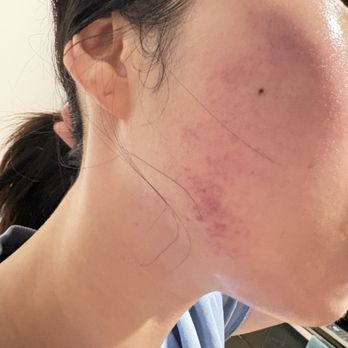 Piboo - Skin Care Near Me - Los Angeles, California