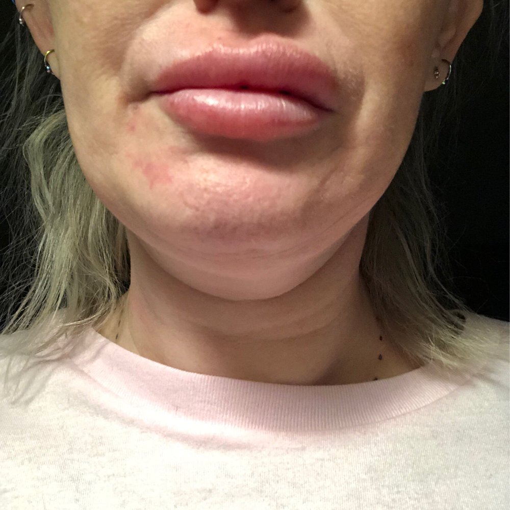 Summit Plastic Surgery & Dermatology - Dermatologists Near Me - Wilmington, North Carolina Summit Plastic Surgery & Dermatology - Dermatologists Near Me - Wilmington, North Carolina