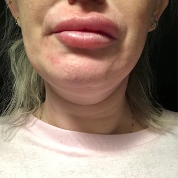 Summit Plastic Surgery & Dermatology - Dermatologists Near Me - Wilmington, North Carolina Summit Plastic Surgery & Dermatology - Dermatologists Near Me - Wilmington, North Carolina