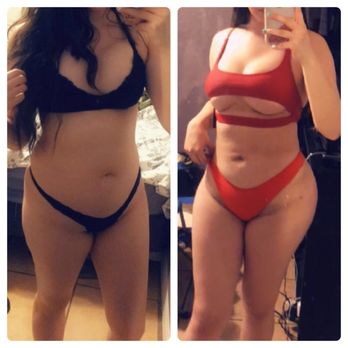 Payam Jarrah - before & after comparison - Cosmetic Surgeons Near Me Payam Jarrah - before & after comparison - Cosmetic Surgeons Near Me