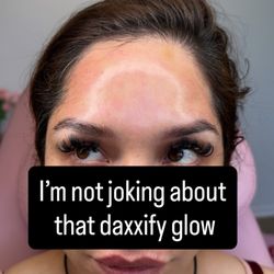 Aesthoria Aesthetics Medical Spa - Did you know daxxify neurotoxin gives an amazing glow? After microtox