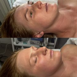Harmony Elixir Spa - Harmony facial