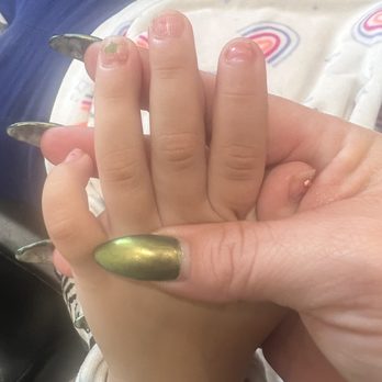 Lovely's Nails & Spa - Almost every fingernail is completely lifting from fungus - Nail Salons Near Me - Chula Vista, California Lovely's Nails & Spa - Almost every fingernail is completely lifting from fungus - Nail Salons Near Me - Chula Vista, California
