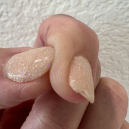 1 week after Dip. Crack on Thumb and notice the edge of index finer