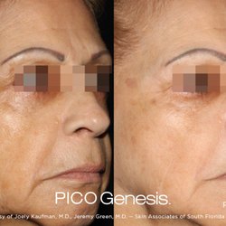 Refined Skin Medi-Spa - PICO Genesis