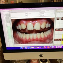 Collins Orthodontics - Before