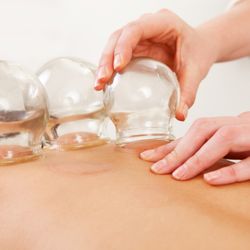 The Acupuncturist - Cupping moves stagnant and toxic energy out of the body. Many liken it to a massage and feel incredibly relaxed afterwards.
