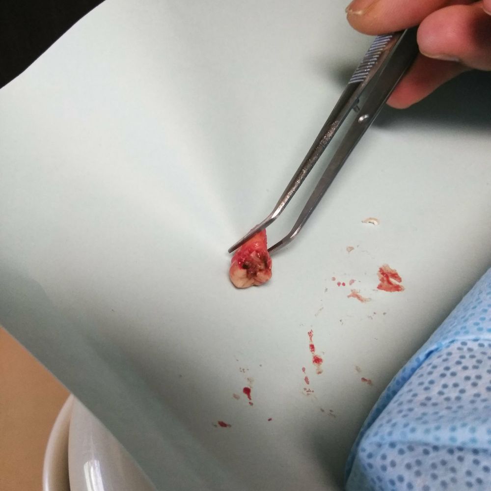 Amit Shah, DDS - Creative Smiles - Lol I didn't even feel it! - General Dentistry Near Me - Fullerton, California Amit Shah, DDS - Creative Smiles - Lol I didn't even feel it! - General Dentistry Near Me - Fullerton, California