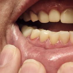 Westport Dental - After
