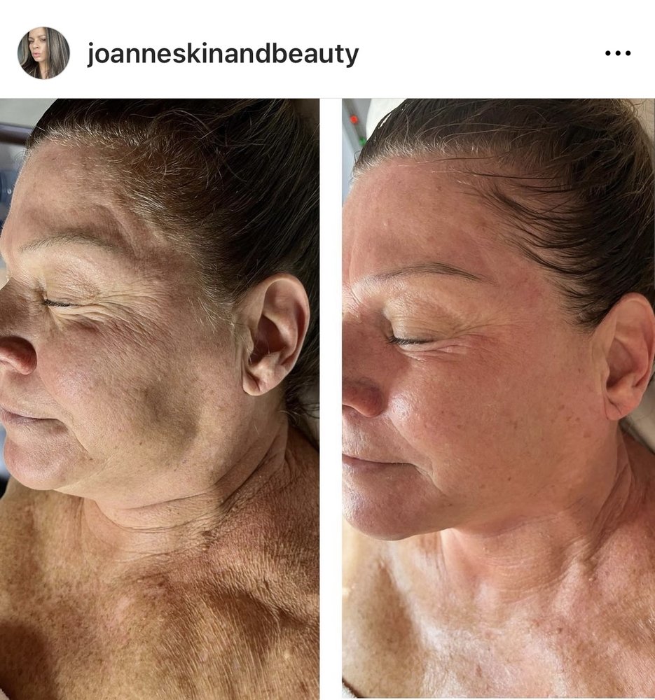 Beauty and the Skin by JoAnne Logo