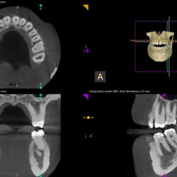 Merrimack Valley Endodontics