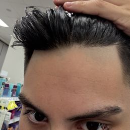 The beginning of my hairline is where the shaved parts are. The beginning of my hairline is where the shaved parts are.