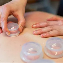 Embody Healing Arts Medical Massage - Massage Cupping achieves many of the benefits of deep tissue work without the residual soreness.