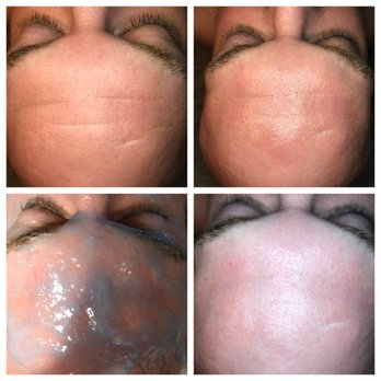 New Skin Rituals - Micro-current with Hydro Infusion - Waxing Near Me - Henderson, Nevada New Skin Rituals - Micro-current with Hydro Infusion - Waxing Near Me - Henderson, Nevada