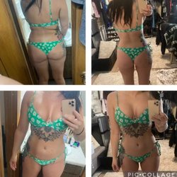 Weight Loss Shots
