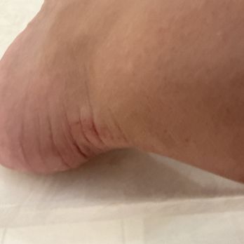 Majestic Nail Bar - Abrasions on my heel from the sawing with the stone. - Nail Salons Near Me - Plano, Texas