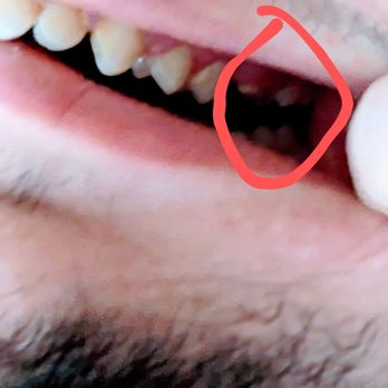 Aspen Dental - Waterloo, IA - Oral Surgeons Near Me - Waterloo, Iowa