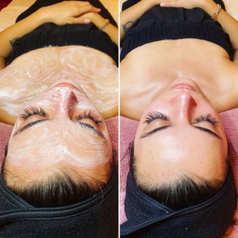 Triumphant Light - Enzyme facials always leave your skin glowing! - Skin Care Near Me - The Dalles, Oregon