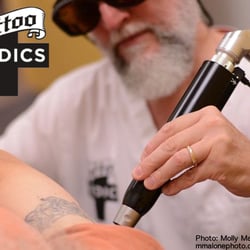 TattooMedics Laser Tattoo Removal