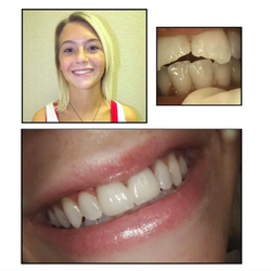 Catherine Koo, DDS - Dentistry In Frisco