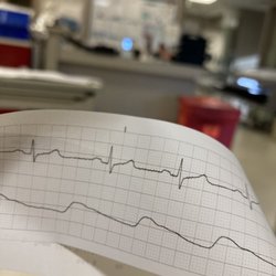 Stanislaus Cardiology - See those glorious P-waves? That's the sound of my atria filling up.