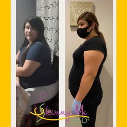 Photo of Skinny Me Med - Van Nuys, CA, US. 31lbs down in 2 months! And still counting!!