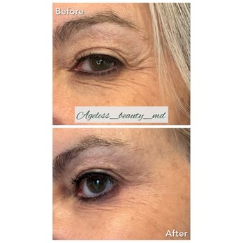 Vivana, MD - Botox before and after - Skin Care Near Me - Destin, Florida Vivana, MD - Botox before and after - Skin Care Near Me - Destin, Florida