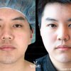 Wave Plastic Surgery & Aesthetic Laser Center: Costa Mesa gift card