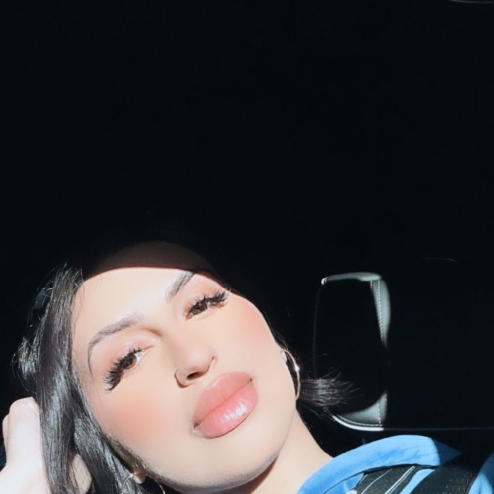 Lazer Lounge - Post touch up ! Loving them Def needed a full syringe . - Laser Hair Removal Near Me - Studio City, California Lazer Lounge - Post touch up ! Loving them Def needed a full syringe . - Laser Hair Removal Near Me - Studio City, California