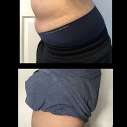 BodySculpt305