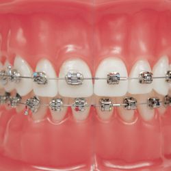 Metro Smiles - Waukegan