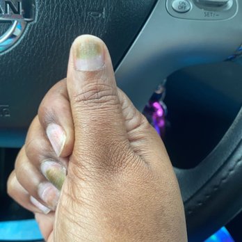 Spectrum Nail Spa - Fungus on my thumb - Nail Salons Near Me - Charlotte, North Carolina