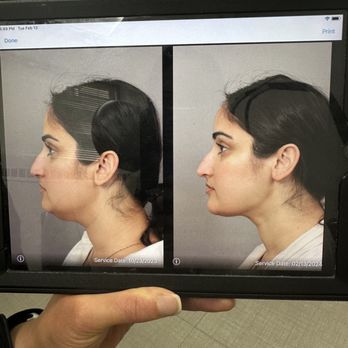 West End Plastic Surgery - Medical Spas Near Me - Washington, DC, District of Columbia