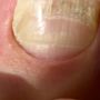 Photo of Elite Foot And Ankle Associates